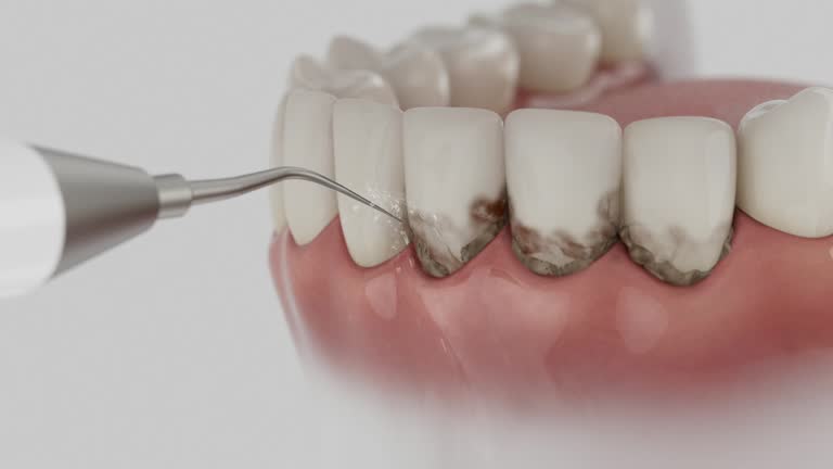 Reliable Dental Implants contractor in Highspire, PA by Smile Center Dentistry